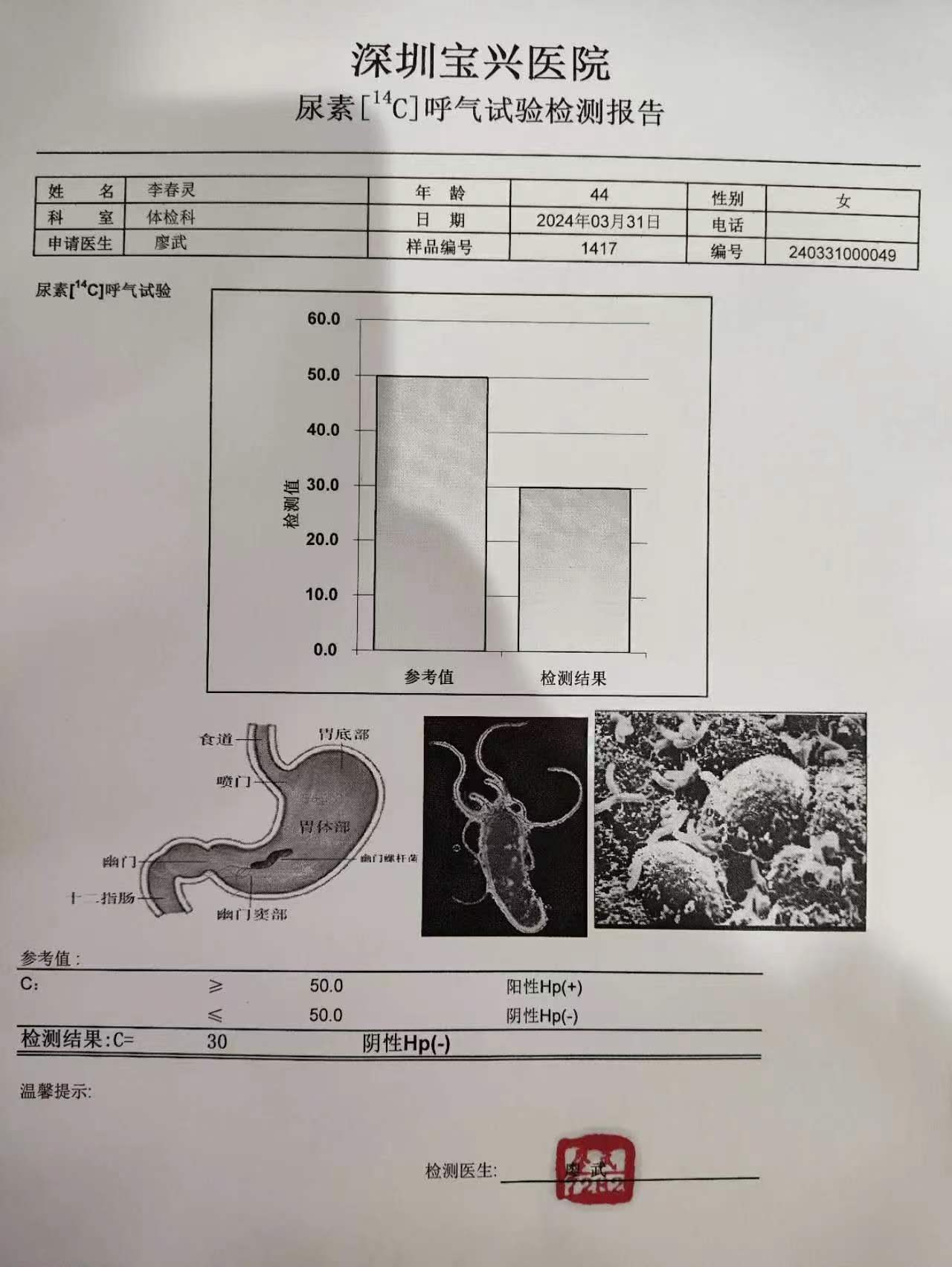 獲得術(shù)前三項(xiàng)